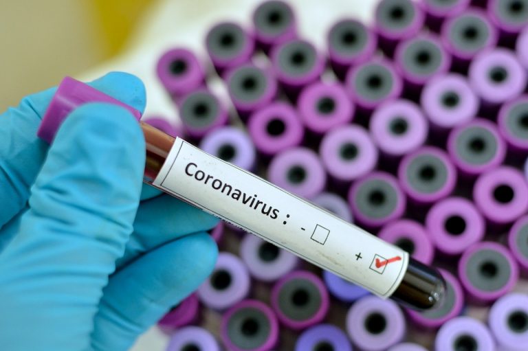 Coronavirus plan actuación