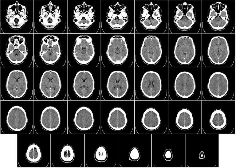 Cerebro