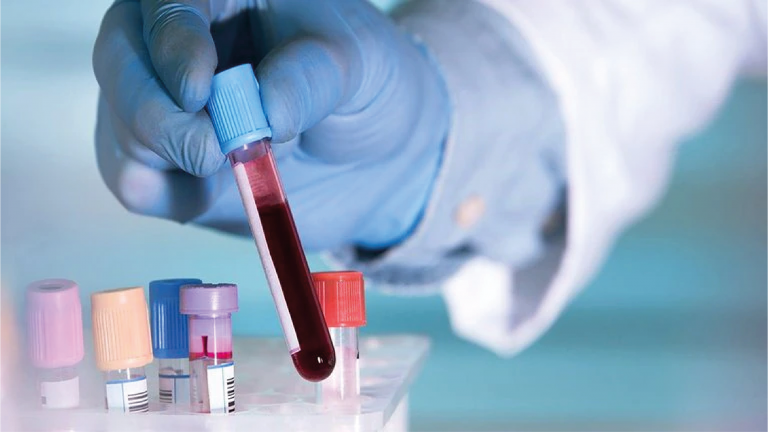 Test de sangre detecta 50 tipos de cancer