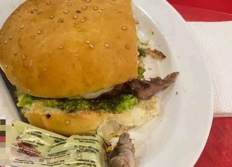 Hamburguesa con dedo humano