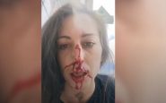 Agredida joven por defender un perro