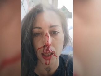 Agredida joven por defender un perro