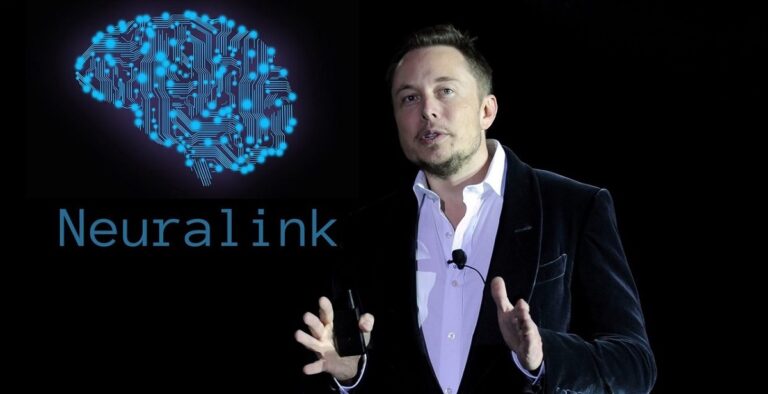 Elon Musk implantes
