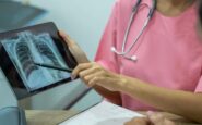 Alerta sanitaria tuberculosis
